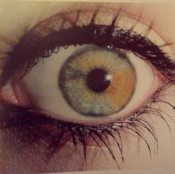 Eye