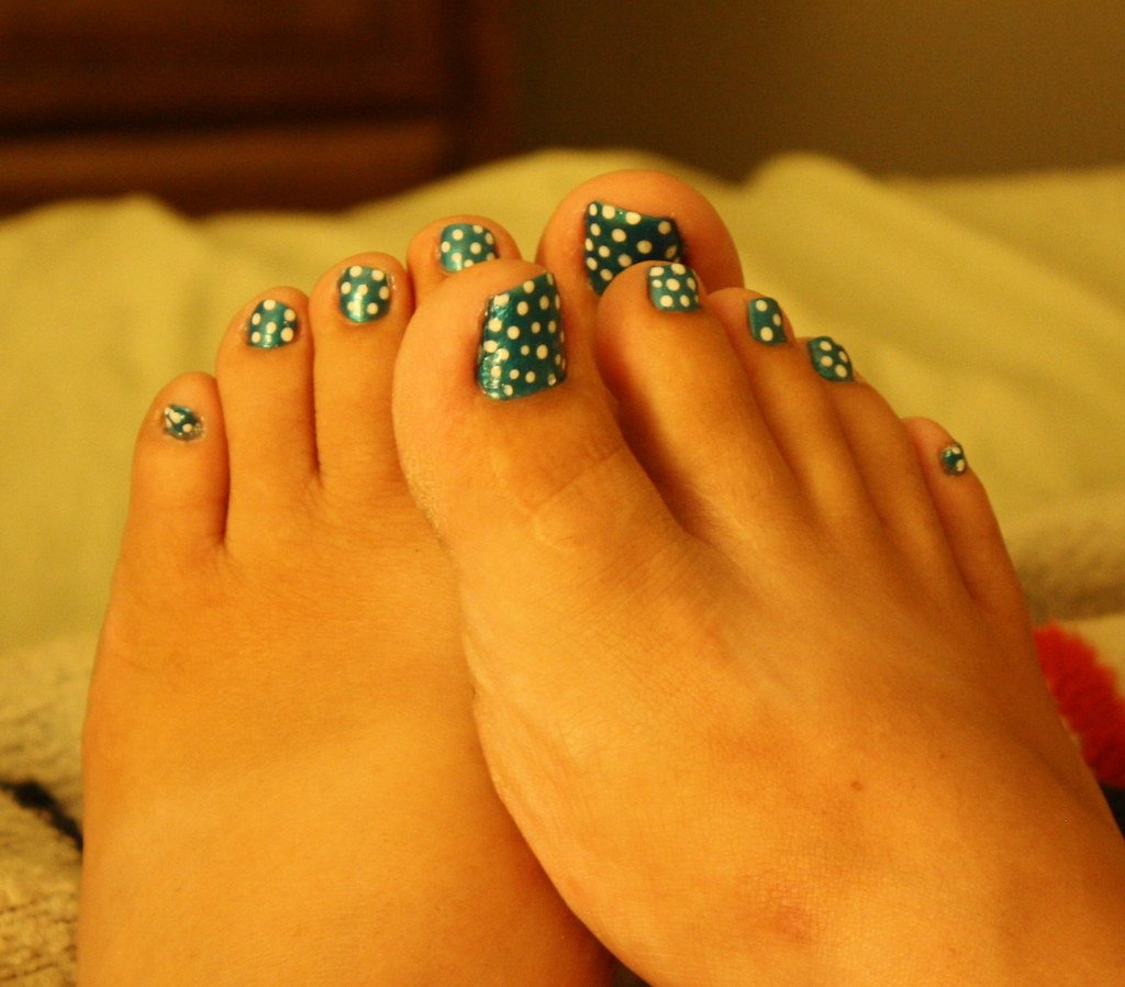 polka-dotted pedicure