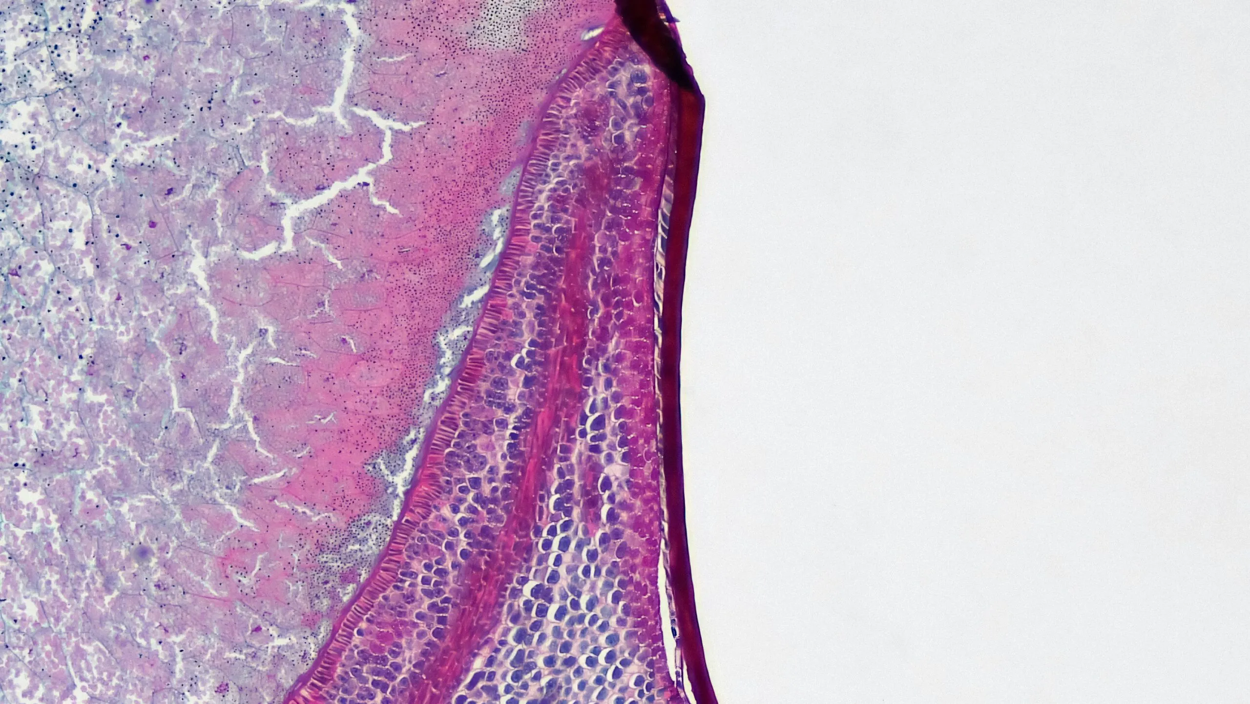 Endosperm, Protective Cotelydon Tip and Bran in Zea Mays Embryo cross section: Zea may embryo common name: corn grain magnification: 40x Triarch quadruple stain https://www.flickr.com/photos/146824358@N03/46915320104/